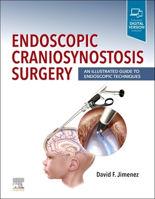 Endoscopic Craniosynostosis Surgery: An Illustrated Guide to Endoscopic Techniques By David F. Jimenez (Editor) Cover Image