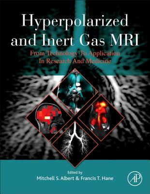 Hyperpolarized and Inert Gas MRI: From Technology to Application in Research and Medicine Cover Image