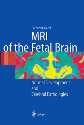 MRI of the Fetal Brain: Normal Development and Cerebral Pathologies Cover Image