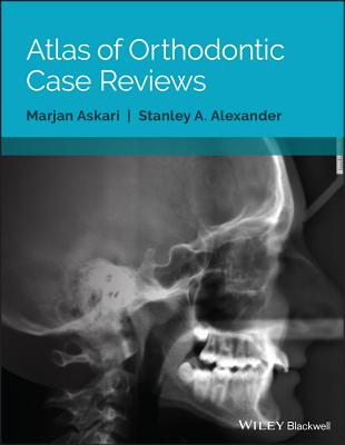 Atlas of Orthodontic Case Reviews Cover Image