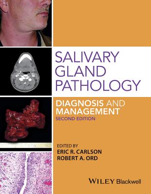 Salivary Gland Pathology: Diagnosis and Management By Robert A. Ord, Eric R. Carlson Cover Image