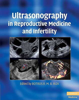 Ultrasonography in Reproductive Medicine and Infertility (Cambridge Medicine) Cover Image