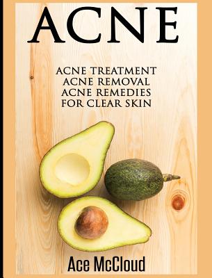 Acne: Acne Treatment: Acne Removal: Acne Remedies For Clear Skin Cover Image
