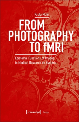 From Photography to Fmri: Epistemic Functions of Images in Medical Research on Hysteria  Cover Image