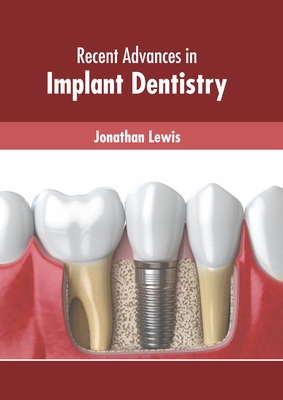 Recent Advances in Implant Dentistry By Jonathan Lewis (Editor) Cover Image