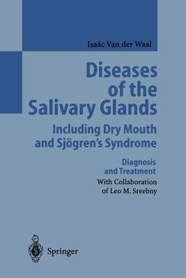 Diseases of the Salivary Glands Including Dry Mouth and Sjögren's Syndrome: Diagnosis and Treatment Cover Image