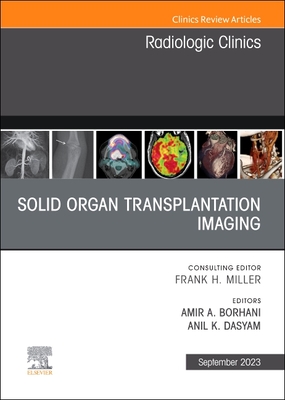 Solid Organ Transplantation Imaging, an Issue of Radiologic Clinics of North America: Volume 61-5 (Clinics: Radiology #61) Cover Image