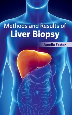 Methods and Results of Liver Biopsy Cover Image