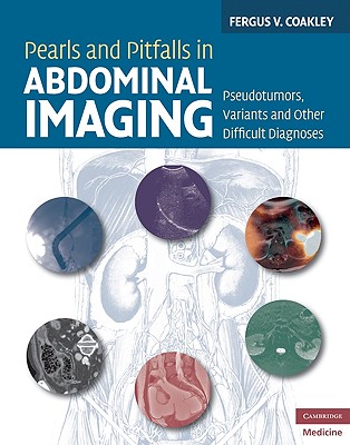 Pearls and Pitfalls in Abdominal Imaging: Pseudotumors, Variants and Other Difficult Diagnoses (Cambridge Medicine) By Fergus V. Coakley Cover Image