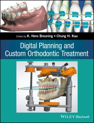 Digital Planning and Custom Orthodontic Treatment Cover Image