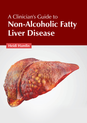 A Clinician's Guide to Non-Alcoholic Fatty Liver Disease Cover Image
