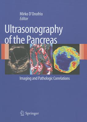 Ultrasonography of the Pancreas: Imaging and Pathologic Correlations By Mirko D'Onofrio (Editor) Cover Image