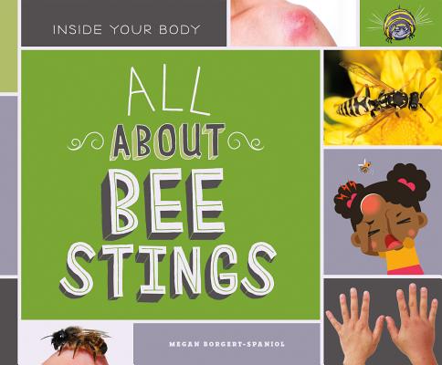 All about Bee Stings (Inside Your Body)