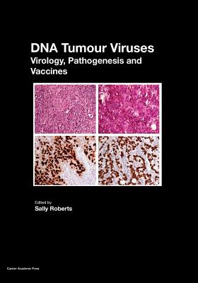 DNA Tumour Viruses: Virology, Pathogenesis and Vaccines By Sally Roberts (Editor) Cover Image