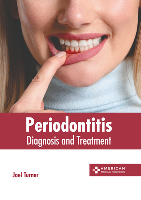 Periodontitis: Diagnosis and Treatment Cover Image