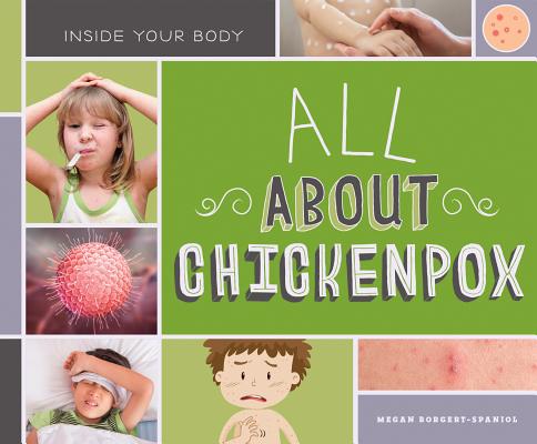All about Chickenpox (Inside Your Body)