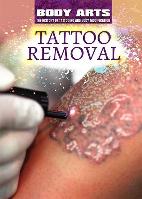 Tattoo Removal By Nicholas Faulkner, Frank Spalding Cover Image