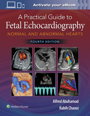 A Practical Guide to Fetal Echocardiography: Normal and Abnormal Hearts Cover Image