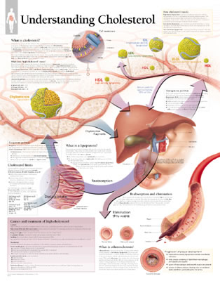 Understanding Cholesterol Chart: Laminated Wall Chart Cover Image