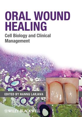 Oral Wound Healing: Cell Biology and Clinical Management Cover Image