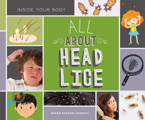 All about Head Lice (Inside Your Body) By Megan Borgert-Spaniol Cover Image