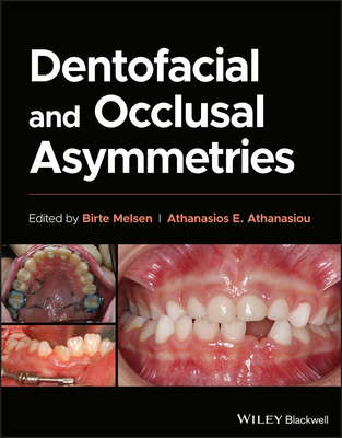 Dentofacial and Occlusal Asymmetries By Birte Melsen (Editor), Athanasios E. Athanasiou (Editor) Cover Image