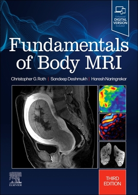 Fundamentals of Body MRI (Fundamentals of Radiology) Cover Image