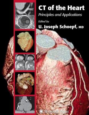 CT of the Heart: Principles and Applications (Contemporary Cardiology) Cover Image