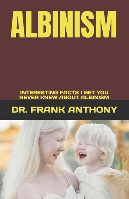 Albinism: Interesting Facts I Bet You Never Knew about Albinism Cover Image
