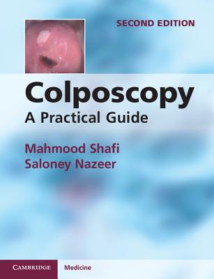 Colposcopy Cover Image