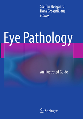 Eye Pathology: An Illustrated Guide Cover Image