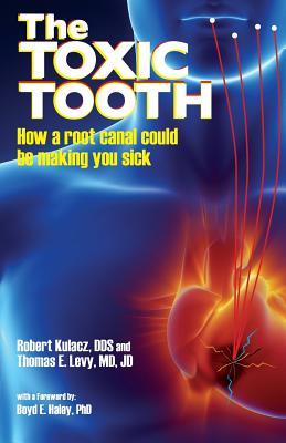 The Toxic Tooth: How a root canal could be making you sick By Robert Kulacz, Jd Levy Cover Image