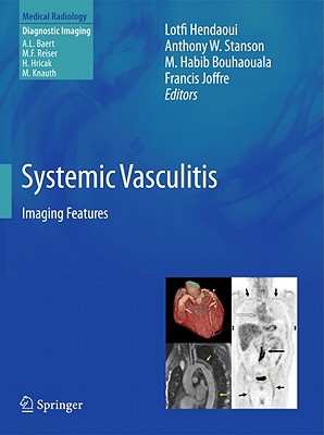 Systemic Vasculitis: Imaging Features By Lotfi Hendaoui (Editor), Anthony W. Stanson (Editor), M. Habib Bouhaouala (Editor) Cover Image