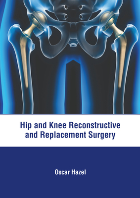 Hip and Knee Reconstructive and Replacement Surgery Cover Image