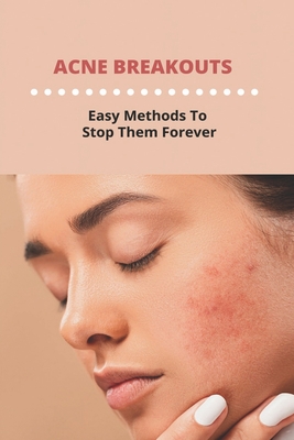 Acne Breakouts: Easy Methods To Stop Them Forever By Michale Commendatore Cover Image