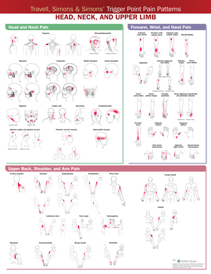 Travell, Simons & Simons’ Trigger Point Pain Patterns Wall Chart: Head, Neck, and Upper Limb Cover Image
