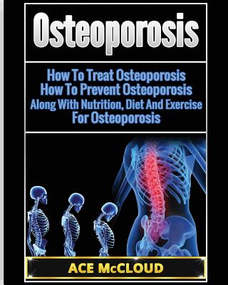 Osteoporosis: How To Treat Osteoporosis: How To Prevent Osteoporosis: Along With Nutrition, Diet And Exercise For Osteoporosis (Reverse or Prevent Bone Loss from Osteoporosis All)