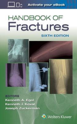 Handbook of Fractures Cover Image