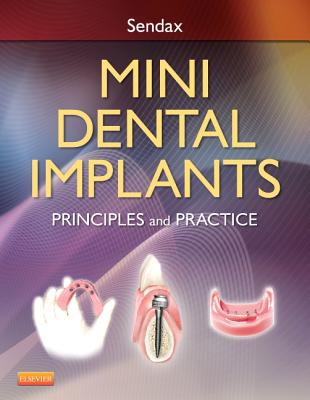 Mini Dental Implants: Principles and Practice Cover Image