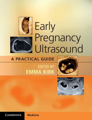 Early Pregnancy Ultrasound: A Practical Guide Cover Image