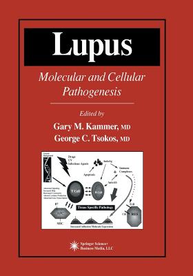 Lupus: Molecular and Cellular Pathogenesis (Contemporary Immunology) Cover Image