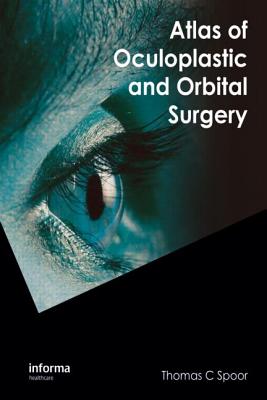 Atlas of Oculoplastic and Orbital Surgery (Hardcover