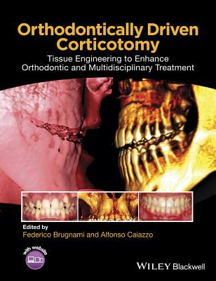 Orthodontically Driven Corticotomy: Tissue Engineering to Enhance Orthodontic and Multidisciplinary Treatment Cover Image