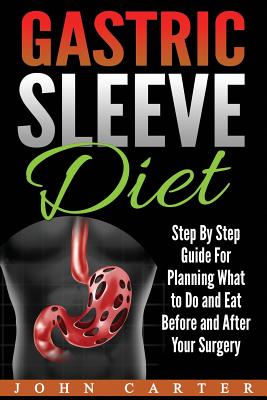 Gastric Sleeve Diet: Step By Step Guide For Planning What to Do and Eat Before and After Your Surgery (Gastric Sleeve Cookbook)
