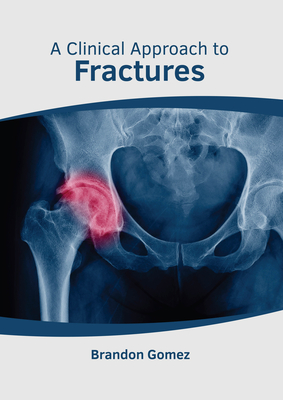 A Clinical Approach to Fractures Cover Image