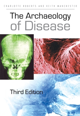 The Archaeology of Disease Cover Image