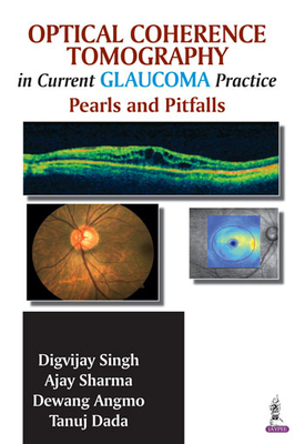 Optical Coherence Tomography in Current Glaucoma Practice: Pearls and Pitfalls