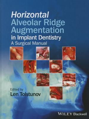 Horizontal Alveolar Ridge Augmentation in Implant Dentistry: A Surgical Manual By Len Tolstunov Cover Image