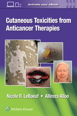 Cutaneous Toxicities from Anticancer Therapies Cover Image