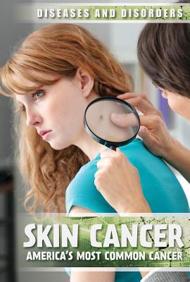 Skin Cancer: America's Most Common Cancer (Diseases & Disorders) Cover Image